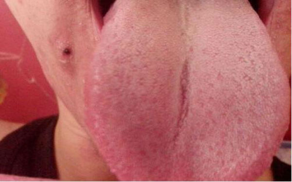 2023湘潭臉部提升除皺術(shù)前10強(qiáng)的專家(彭朝、周剛、李為儒多數(shù)人選擇！)