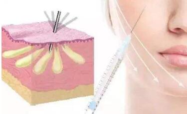 廈門時光整形美容專家為你呈現(xiàn)完美雙眼皮