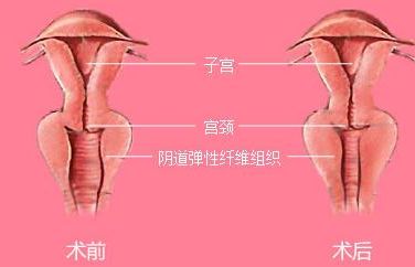 長(zhǎng)沙靠譜矯正醫(yī)院哪家好？解答你所有的疑慮！