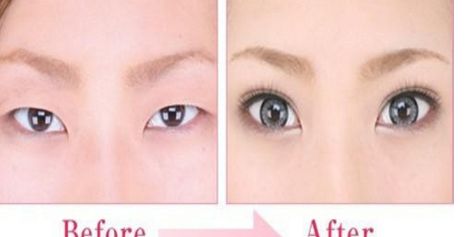 貴陽鼻部整形醫(yī)院哪家好？綜合排名及用戶評(píng)價(jià)一覽