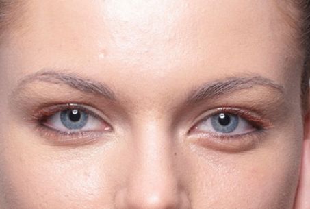 成都有哪些專業(yè)的祛斑祛痘印機(jī)構(gòu)值得推薦？