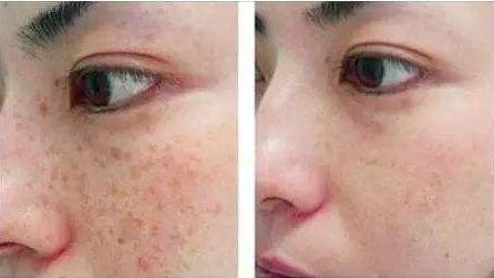 包頭哪家醫(yī)院做隆胸好？全面解析包頭市評(píng)價(jià)最高的隆胸醫(yī)院