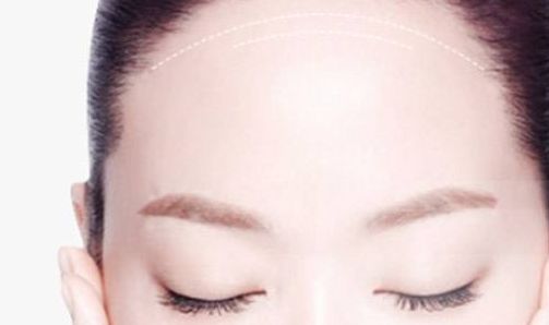 南京做修復(fù)雙眼皮哪家好？解析南京修復(fù)雙眼皮的最佳選擇