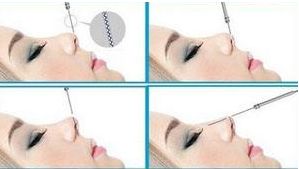 四川哪家醫(yī)院治療狐臭效果好，口碑最佳？