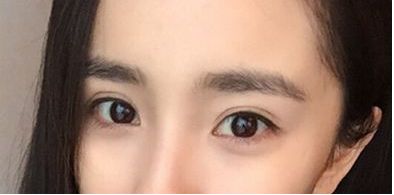 珠海市祛斑好的醫(yī)院哪家靠譜？