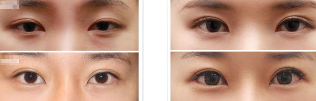 河南哪家醫(yī)院修復(fù)疤痕效果好【2023更新】