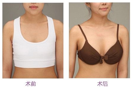 2023中山微電波拉皮除皺專家TOP10(胡可斌、肖鵬飛、鄭秋菊出名靠譜！)