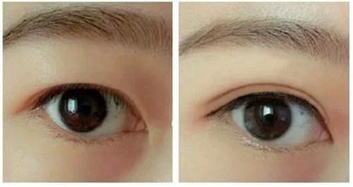 2023秦皇島深藍(lán)射頻面部排行前十強(qiáng)的醫(yī)生(王強(qiáng)、劉運(yùn)濤、池建強(qiáng)推薦指數(shù)五顆星)