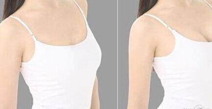 中國醫(yī)科大學附屬醫(yī)院美容科卓越醫(yī)生名單，親測案例圖詳解！