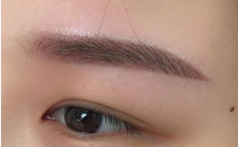 杭州哪家醫(yī)院做隆胸效果好？