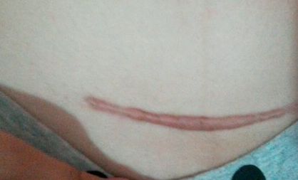 南京激光祛皺紋哪家醫(yī)院好？探尋南京最受歡迎的激光祛皺紋醫(yī)院