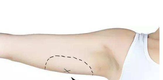 南京去除黃褐斑醫(yī)院排名及口碑，哪家值得信賴？