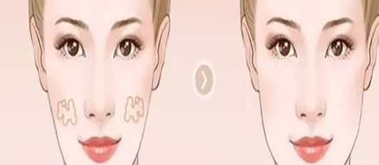 南京哪家醫(yī)院的小陰唇整形效果好？