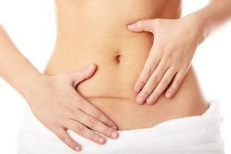 【鄭州哪家醫(yī)院治療腋臭好？詳細對比解析！】