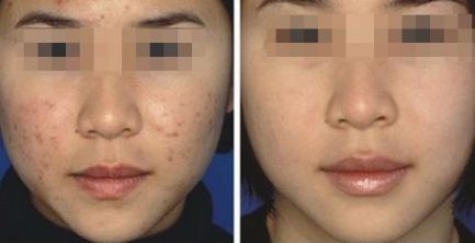 連云港眼部激光飛秒那家好？排名領(lǐng)先的專業(yè)眼科醫(yī)院推薦