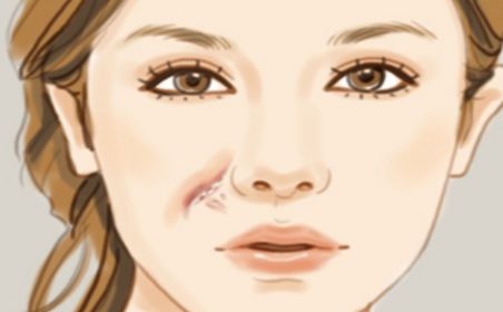 天津有哪些醫(yī)院的祛痘效果好？哪家醫(yī)院的祛痘效果最佳？