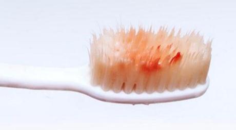 2023西安熱瑪吉消除眼部細(xì)紋專家上榜清單前10位(肖志華、雷靜、陳偉讓整形更有保障)