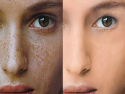 2023廣西面部提拉微整形榜單top10強(qiáng)醫(yī)生(梁東、張奕梅、蒙誠躍口碑好，人氣也很旺！)