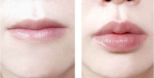 山東隱耳整形哪家醫(yī)院好？專業(yè)評測及患者真實分享