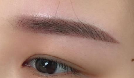 浙一醫(yī)院徐靖宏抽脂效果滿意嗎？有全新價格表嗎？