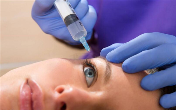 廣州新生毛發(fā)醫(yī)院的治療效果及李傳位醫(yī)生的發(fā)際線植發(fā)結果如何呢？