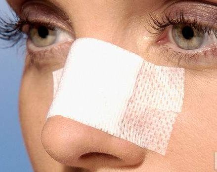 徐州雙眼皮哪家醫(yī)院好？選擇徐州哪家專業(yè)雙眼皮醫(yī)院效果好