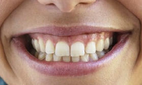 2023常德注射填充祛川字紋口碑排名前十位專家(丁芷林、郝天、羅志軍憑綜合實(shí)力入圍~)