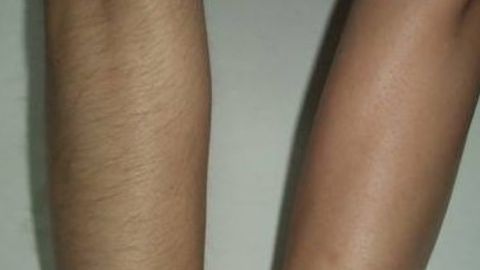 商丘杜韓整形醫(yī)院和華美之間如何選擇？雙眼皮手術(shù)價(jià)格一覽表