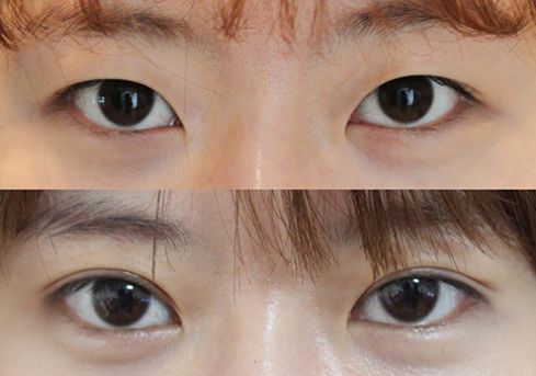 2023昆明生物基因除皺榜單十強醫(yī)生(金漢祚、何黎、張慶森口碑特色一一講解)