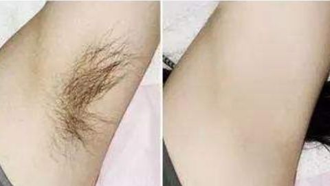 杭州藝星徐利剛醫(yī)生隆鼻項(xiàng)目靠譜嗎？技術(shù)操作曝光，口碑如何？