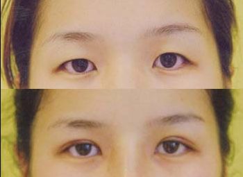 無錫市哪家整形醫(yī)院好？揭秘無錫地區(qū)口碑最佳整形醫(yī)院！