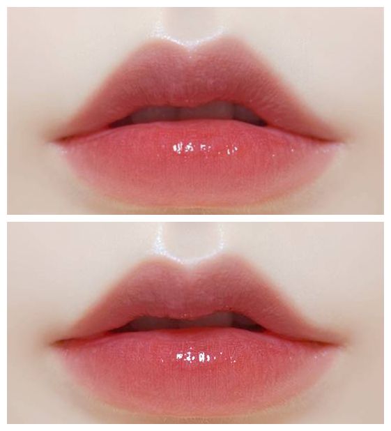 揭秘上海注射玻尿酸醫(yī)院排行榜，哪家好的口碑最高？