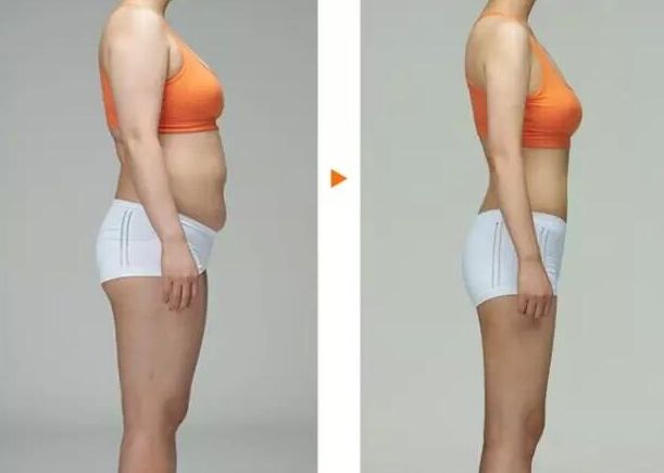 常州去胎記哪家醫(yī)院好？專家推薦常州哪家醫(yī)院胎記治療效果好