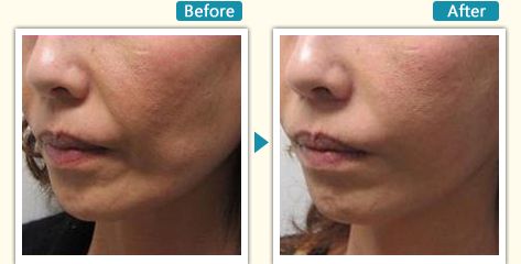 杭州哪家瘦腿針醫(yī)院好？全面解析杭州最受用戶歡迎的瘦腿針醫(yī)院推薦