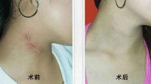 上海中西醫(yī)結(jié)合醫(yī)院整形美容科靠譜嗎？聽(tīng)說(shuō)口碑不錯(cuò)！