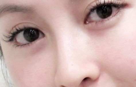 在烏魯木齊有哪些值得推薦的開眼角好醫(yī)院？