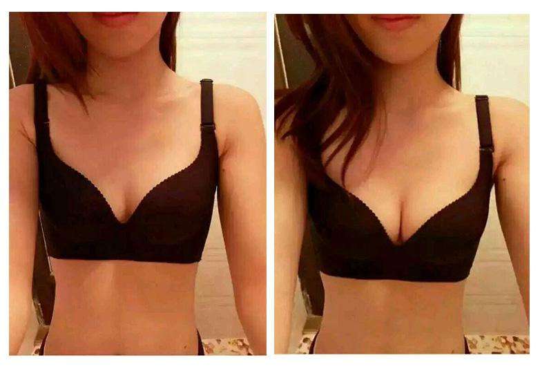 2023廣州熱瑪吉去頸部皺紋正規(guī)專家排行榜TOP10(鄭燕妮、張永義、喬鋒麗技術(shù)及個人簡介一覽)