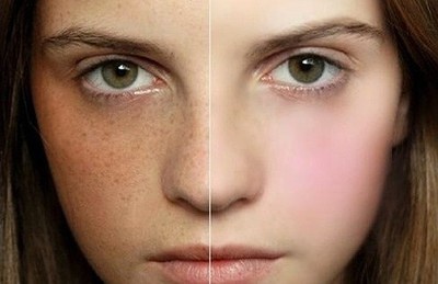 2023無(wú)錫射頻去木偶紋醫(yī)生口碑前十位(陳超、郭曄、袁斯明整形更有保障！)