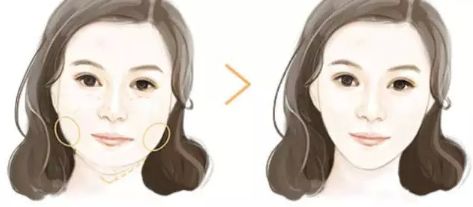 上海哪家下頜骨醫(yī)院好？解析上海下頜骨疾病常見(jiàn)病例及專(zhuān)業(yè)治療！