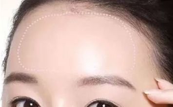 蘇州哪家黃褐斑醫(yī)院好？專(zhuān)業(yè)醫(yī)生推薦，讓你告別黃褐斑困擾！