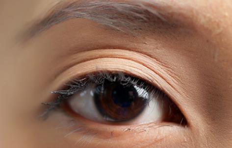 成都哪里有做雙眼皮好的醫(yī)院？分享優(yōu)秀案例