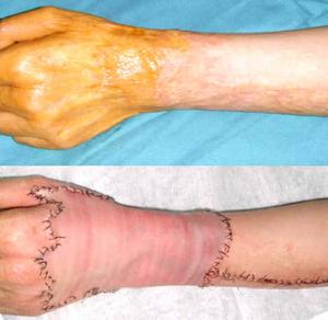 米德傲吸脂技術(shù)優(yōu)勢(shì)分析：醫(yī)生評(píng)價(jià)、收費(fèi)信息先解密！杭州藝星權(quán)威專家！