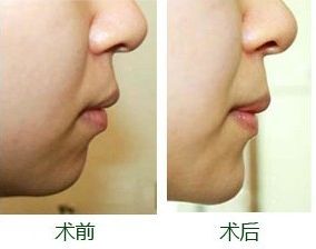 南寧整形豐胸醫(yī)院排名及評價互動：哪家醫(yī)院效果更好？