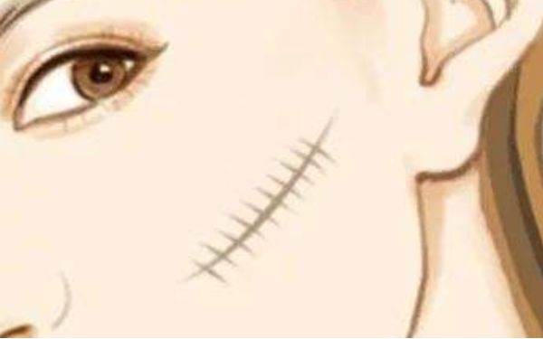 廣州康華清醫(yī)療美容門診部醫(yī)生有哪些擅長(zhǎng)項(xiàng)目？醫(yī)院技術(shù)一覽如何？