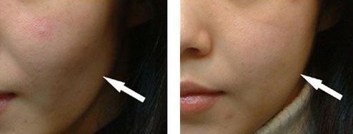 邯鄲美容整形醫(yī)院哪家好？專業(yè)品質(zhì)口碑贊譽醫(yī)院推薦！