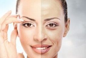 杭州美白祛斑哪家醫(yī)院好？優(yōu)質醫(yī)療機構推薦