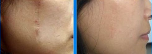 常州拇外翻醫(yī)院哪家醫(yī)院好？專家推薦，附詳細排名和患者口碑評論