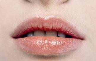 2023寧波玻尿酸去生長紋正規(guī)醫(yī)生排行榜前十名(陳新平、李鶯、卜雙燕好評(píng)不貴)