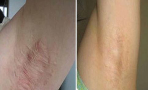 廈門祛雀斑醫(yī)院排名及口碑，哪家好？