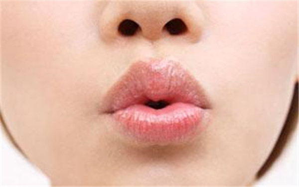 2023寧波熱拉提去眼角紋專家評分前十強(齊強、王忠、翁志宇做的好嗎？)